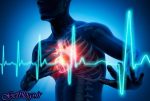اهمیت آنژیوپلاستی ، آمار ۴۶ درصدی فوت قلبی در ایران
